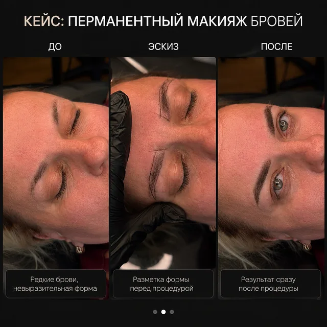 Брови